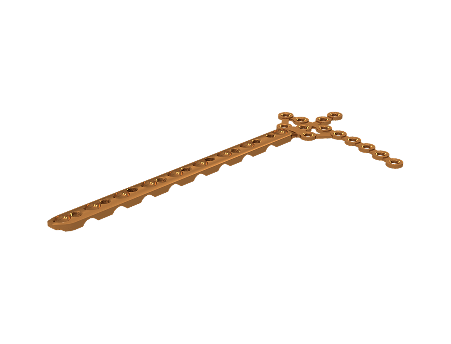 Placa “L” – Tíbia Distal Direita