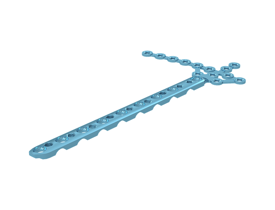 Placa “L” – Tíbia Distal Esquerda